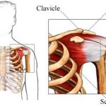 ortho-shouldertendinopathy-390x241